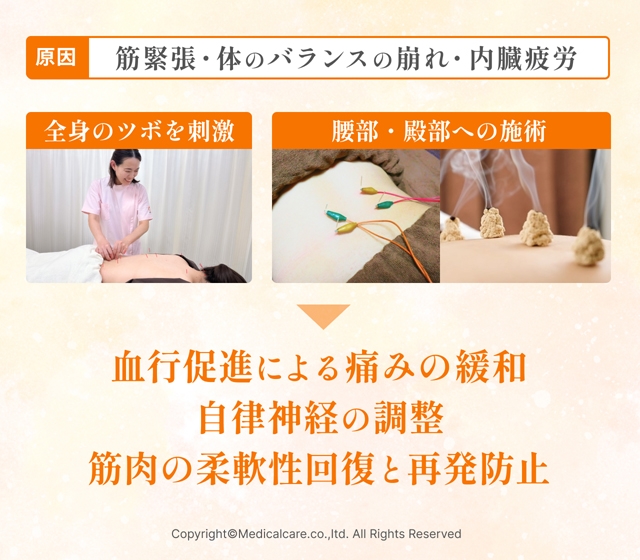 腰痛の鍼灸